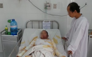 Cứu thai nhi trong bụng sản phụ bị bỏng nặng